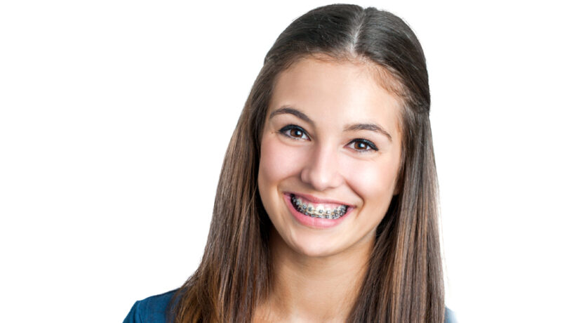 Orthodontic Treatment 101: Everything You Need to Know
