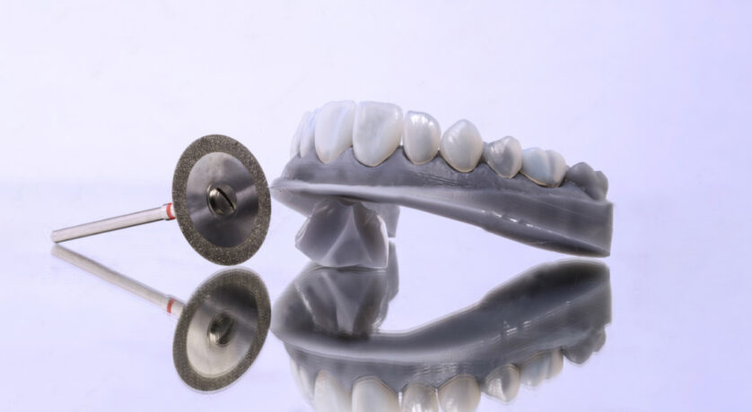 veneers-procedure-recovery