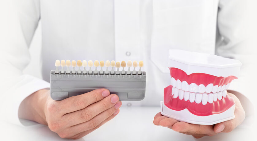 Veneers v/s Lumineers: Everything You Need To know