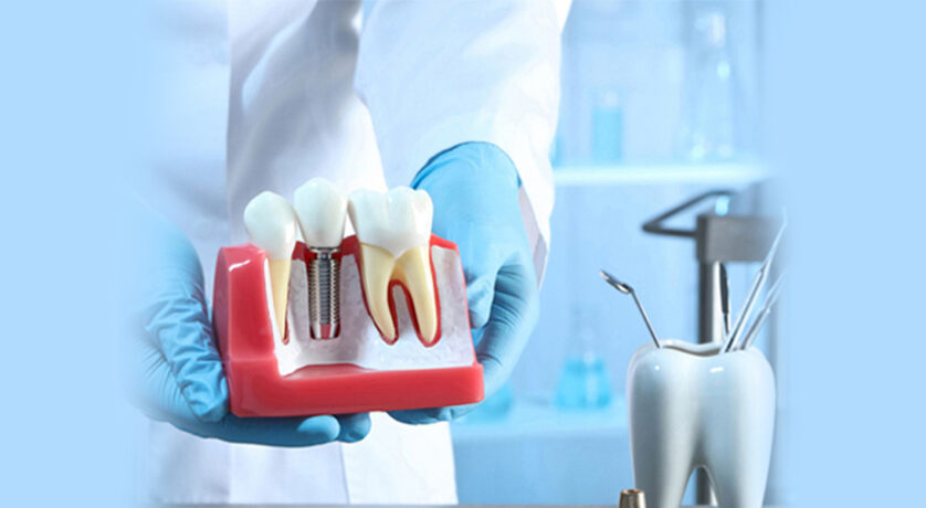 Mini Dental Implants: their Advantages, Disadvantages, and Longevity