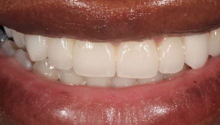 After-before-after
