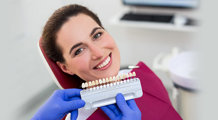 Porcelain Veneers