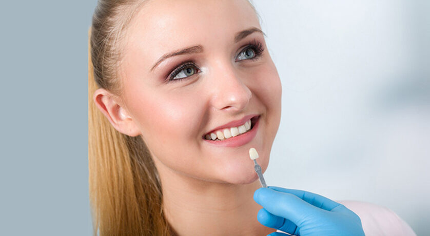 Porcelain Veneers
