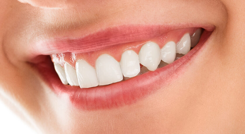 How Do I Fix a Gummy Smile with Cosmetic Dentistry in Philadelphia?