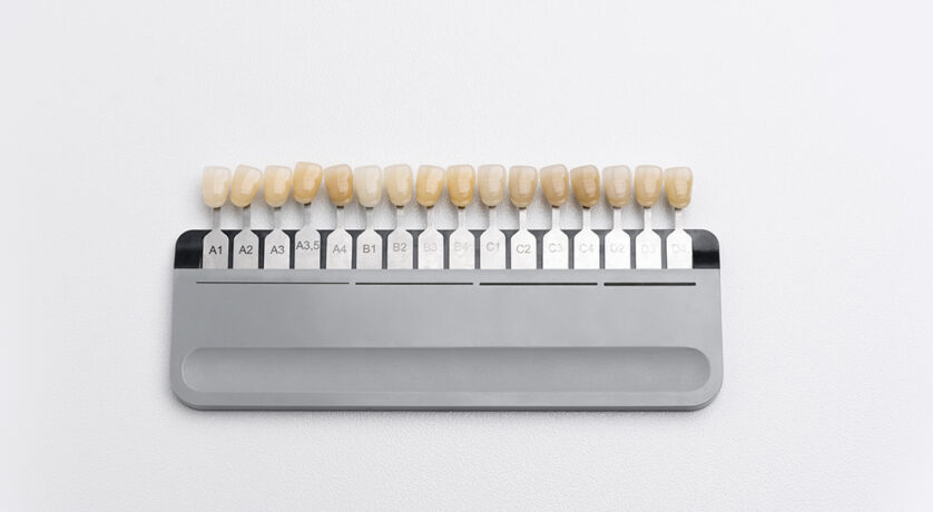 What Materials Are Used in Porcelain Veneers and Why Does It Matter?